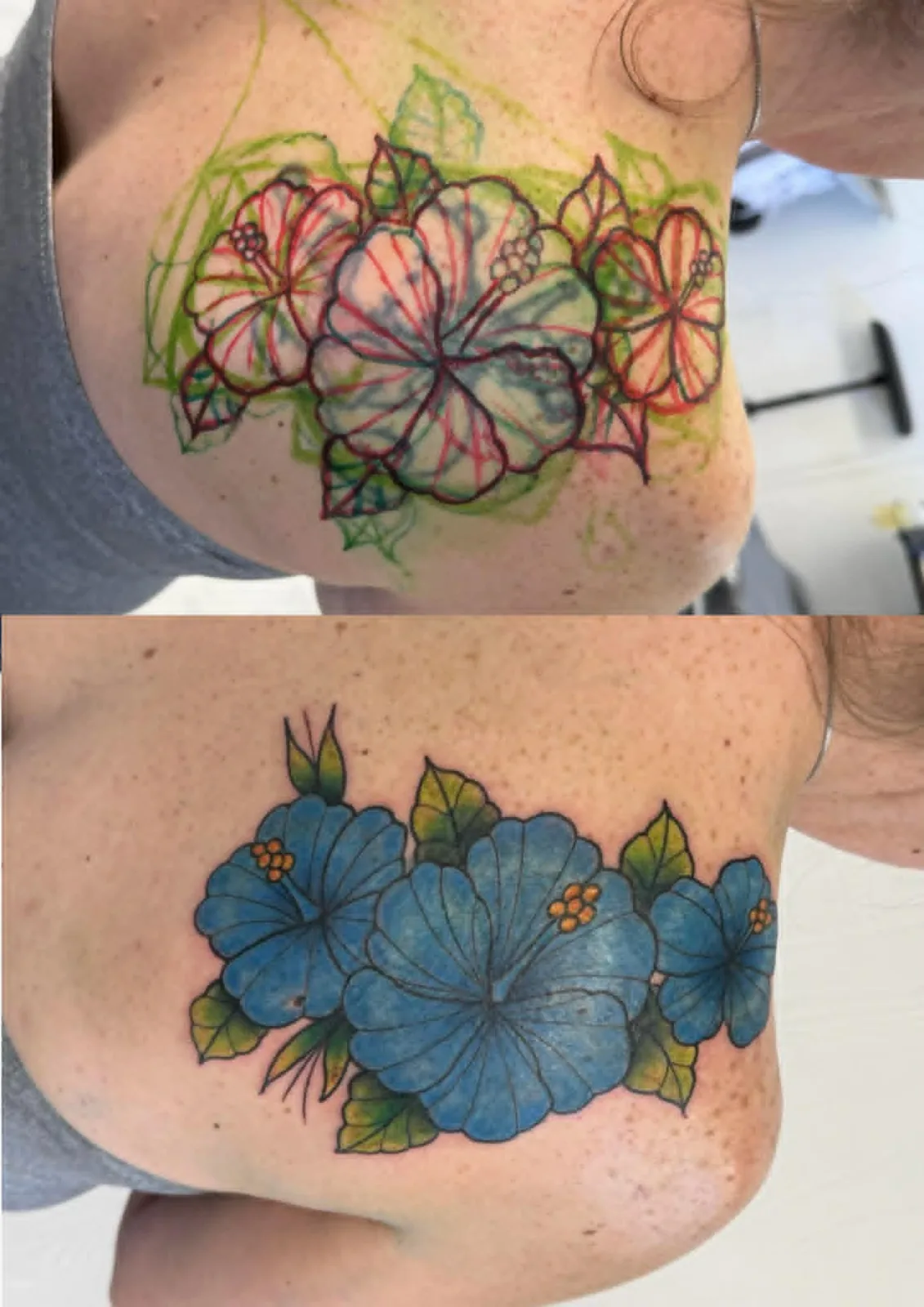 Tattoo cover-up by Carlos Barrera — old chest piece covered with blue hibiscus flowers, before and after